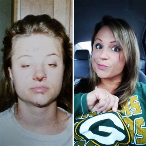 96 Stunning Before And After Transformations Of People Who Quit Drugs