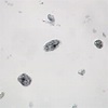 Entamoeba histolytica Trophozoites, smear Microscope Slide | Carolina.com