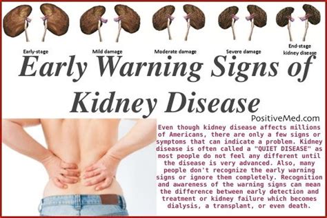 11 Kidney Damage Symptoms Most People Ignore Posts The Ojays And