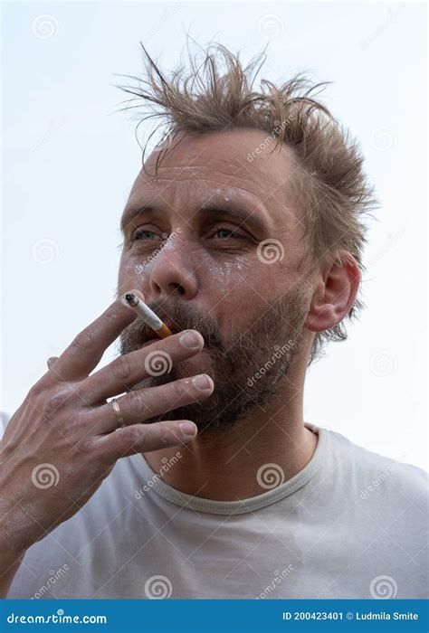 Man With Spotted Face Smoke A Cigarette Stock Image Image Of Relax