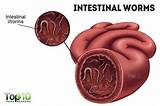 Constant Intestinal Gas Pictures