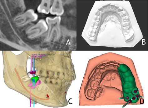 Technology At The Service Of Surgery In A New Technique Of