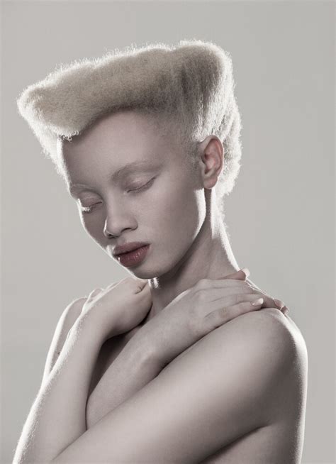 Esthétique de l albinisme Slate fr