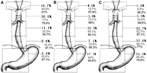 Figure 4 From Clinical Target Volume Delineation For Radiotherapy Of