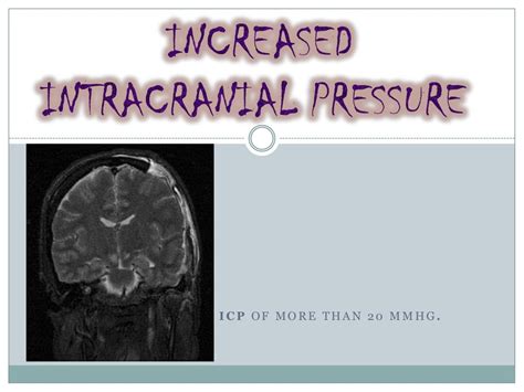 What You Should Know About Intracranial Pressure