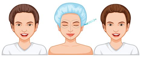 Comparison Of Female Botox Injection 362533 Vector Art At Vecteezy