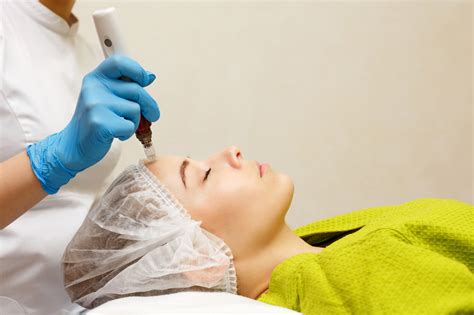 Microdermabrasion Treatment Box Hill Lose It With Laser
