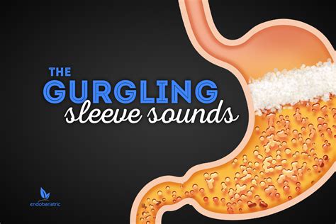 The Gurgling Sleeve Sounds | Gastric sleeve, Bariatric sleeve, Gastric sleeve diet