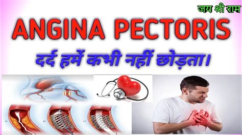Angina Pectoris Cause Pathology Type Pathophysiology Sign