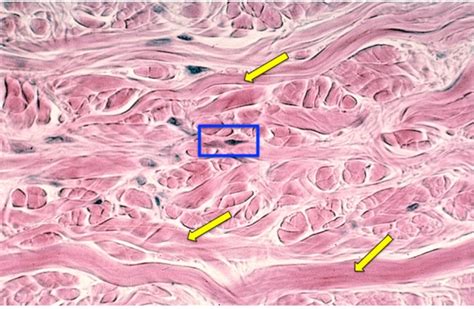 Dense Irregular Collagenous Connective Tissue Diagram Quizlet