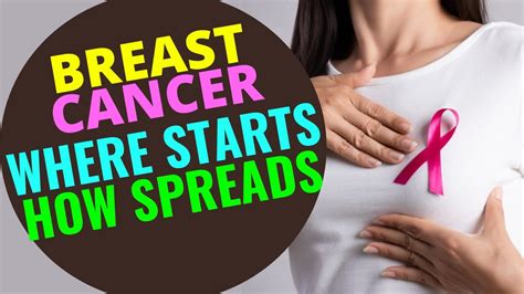 where breast cancer starts and spreads how breast cancer spreads nursing exercise youtube