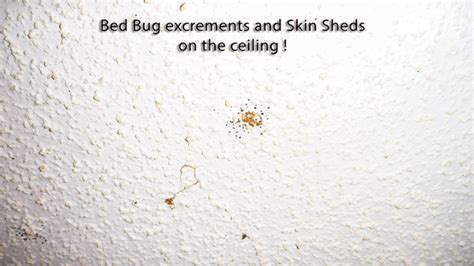 The Worst Case Of Bed Bug Infestation Pest Control Of Bed Bugs Fleas