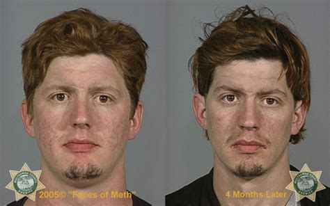 People On Meth Before And After