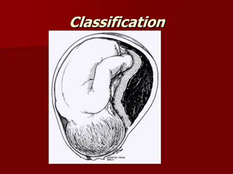 Ppt Placental Abruption Powerpoint Presentation Free Download Id