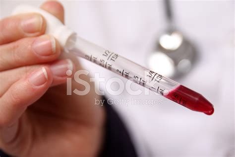 Blood Test Tube Stock Photo Royalty Free Freeimages