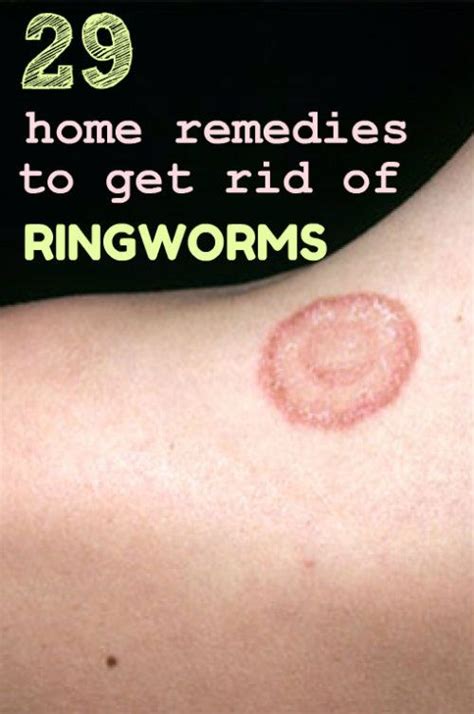 These ingredients kill bacteria and viruses — including the coronavirus — by. Can Hand Sanitizer Kill Ringworm