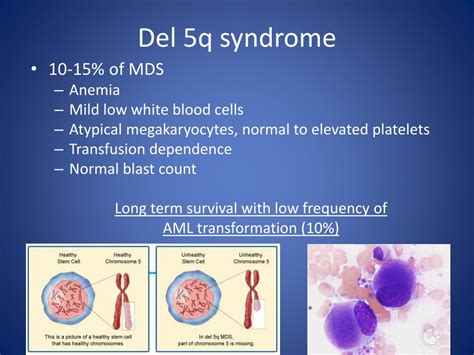 Ppt Current Options And New Developments For Treating Myelodysplastic Syndromes Powerpoint