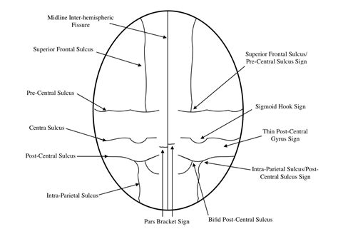 Radiological Anatomy Central Sulcus Stepwards