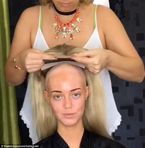 Perth Model With Alopecia Areata Shares Video Of Herself Without A Wig