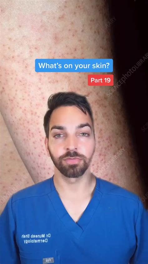 Dr Shah Dermdoctor Official TikTok Watch Dr Shah S Newest TikTok