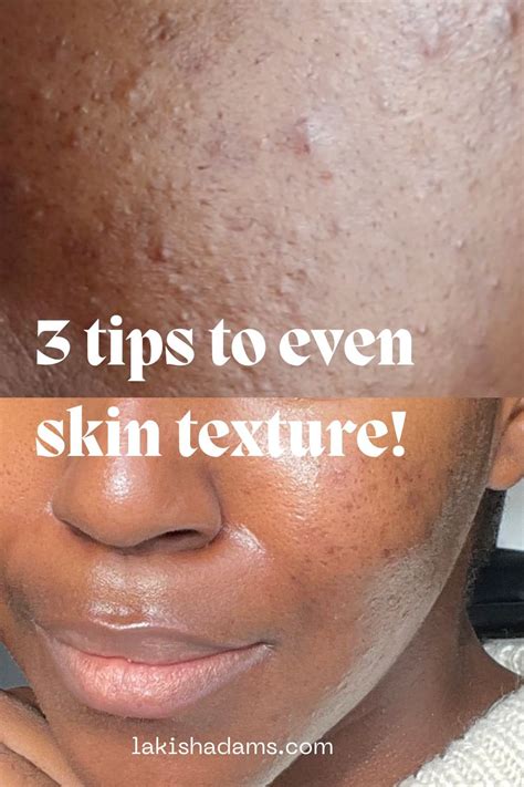 3 Simple Ways To Improve Uneven Skin Tone And Texture — Lakisha Adams