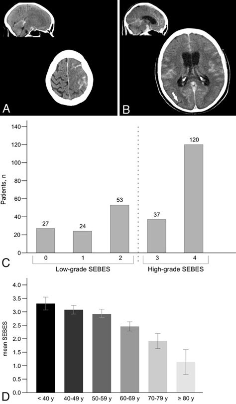 Age Dependency And Modification Of The Subarachnoid Hemorrhage Early