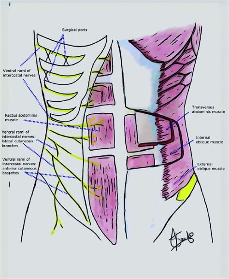 Overview Of Rectus Abdominis Muscle And Nerve Supply The Rectus My Xxx Hot Girl