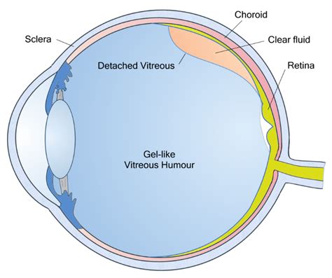 The Vitreous Humour A Jelly Like Substance Is Found In The Posterior