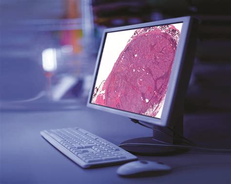 Digital Pathology Gives Rise To Computational Pathology Clinical Lab
