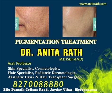 Acne, scars, lasers (hair, tattoo and mole removal), skin whitening, melasma, hair fall treatments and antiaging, skin surgeries and hair. Pin by Dr Rabi on Best Skin Doctor in Bhubaneswar Odisha ...