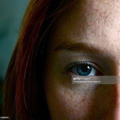 Freckle Faced Blue Eyed Girl Photo Getty Images
