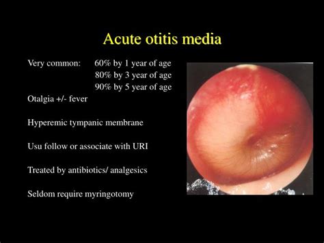 Ppt Diseases Of Middle Ear Powerpoint Presentation Id4007153