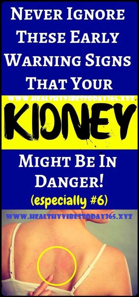 There are usually no symptoms of kidney disease in the early stages. 10 WARNING SIGNS OF KIDNEY DISEASE YOU SHOULD NEVER IGNORE ...