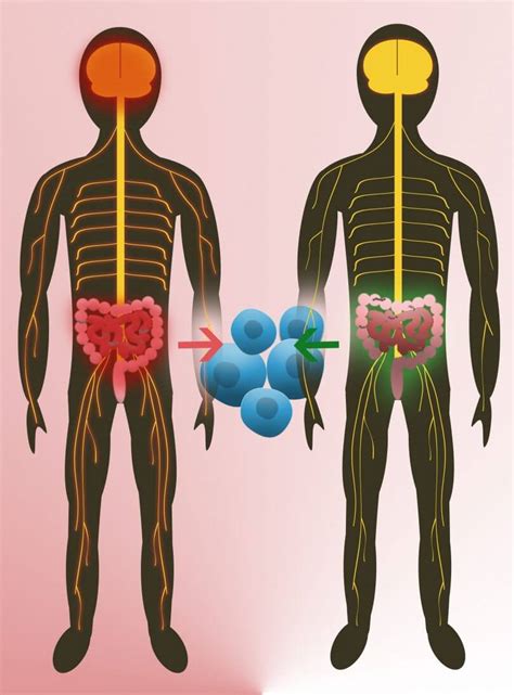 Intestinal Flora From Twins Is Able To Initiate Multiple Sclerosis