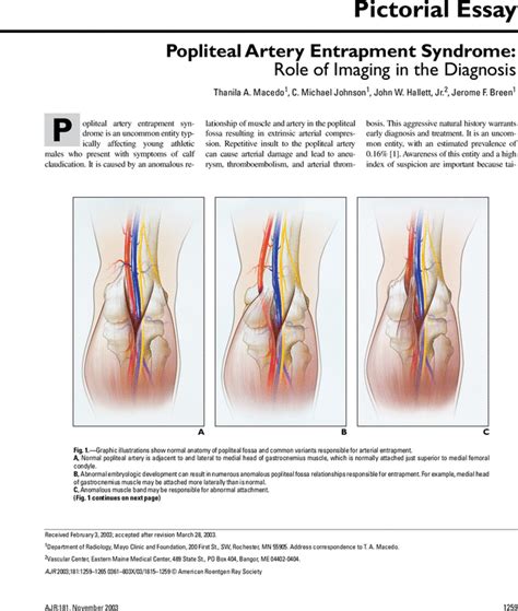 Popliteal Artery Entrapment Syndrome Role Of Imaging In The Diagnosis