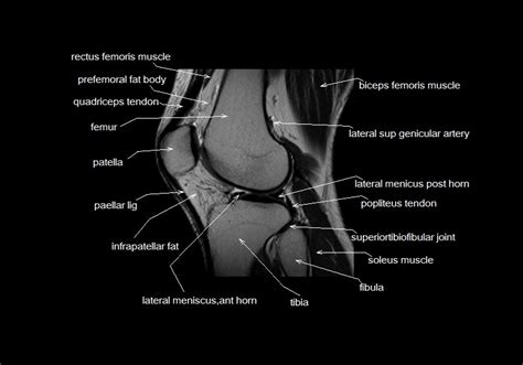 On anatomical parts the user. mri knee anatomy | knee sagittal anatomy | free cross sectional anatomy