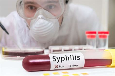 Is It Time For A Syphilis Test Diagnosis And Testing Of Syphilis
