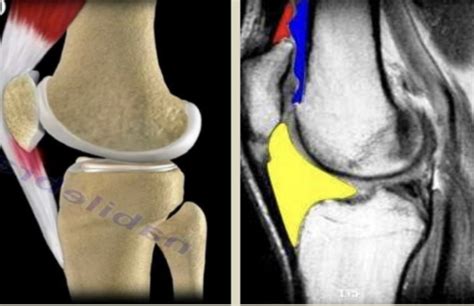 The Treatment Of Knee Pain Core Omaha Explains C O R E Physical