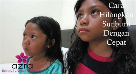 Minyak kelapa merupakan bahan penting dalam produk perawatan kulit dan itu terutama karena memberi nutrisi. Cara Hilangkan Sunburn Dengan Cepat Yang Paling Berkesan ...