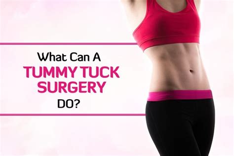 How To Prepare For The Tummy Tuck Procedure