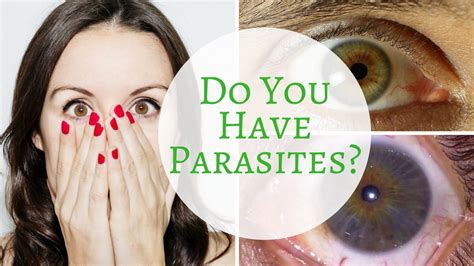 A Way You Can Tell If You Have Parasites Via Iridology Youtube
