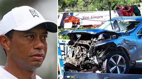 Tiger Woods Car Crash Accident Collision Injuries Compound Leg