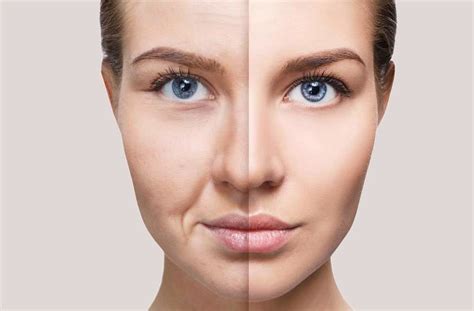 Ácido hialurônico O que é Conheça benefícios para a pele Nati Cosmética