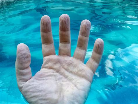 why do fingers get wrinkly after a long bath or swim a biomedical engineer explains