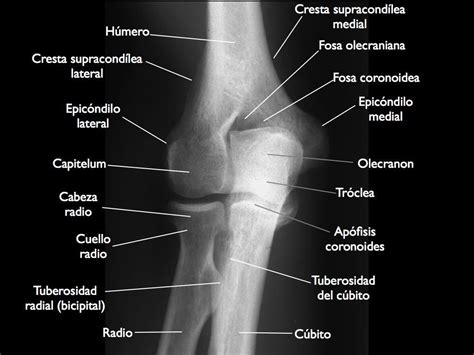 Anatomia De Los Huesos Radiology Student Radiology Me