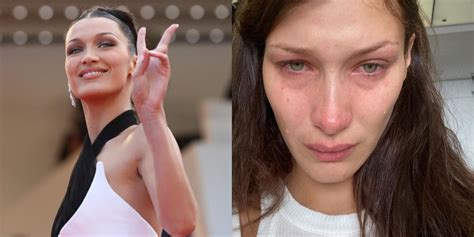 bella hadid opens up about her mental health struggles says ʼsocial media is not realʼ editorji