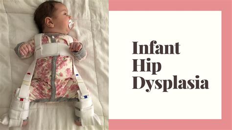 Infant Hip Dysplasia Day 1 Youtube
