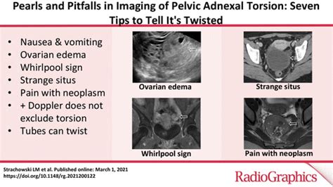 Pearls And Pitfalls In Imaging Of Pelvic Adnexal Torsion Seven Tips To