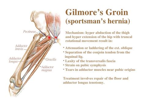 Anatomy And Related Etiology Of Groin Pain