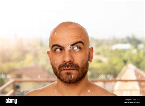 Man Sunburn Peeling Skin Hi Res Stock Photography And Images Alamy